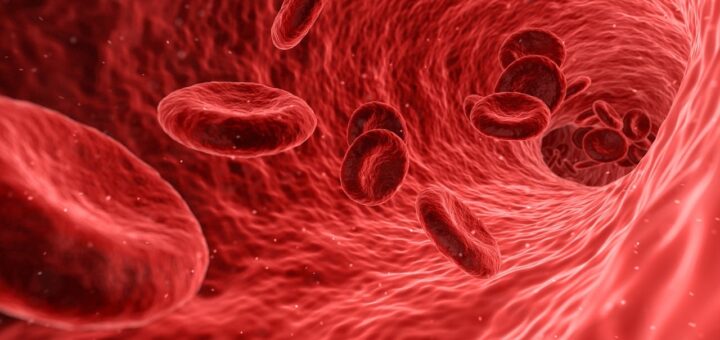 olife e carotidi